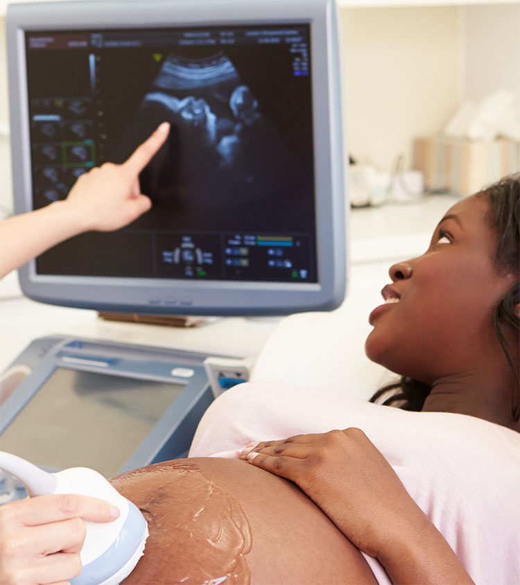 African American pregnant patient getting an ultrasound